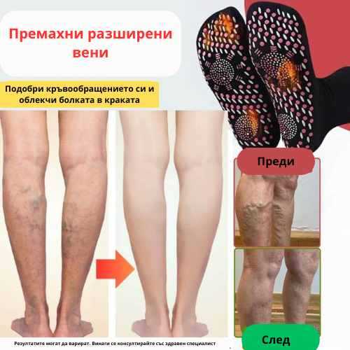 Акупресурни чорапи против разширени вени
