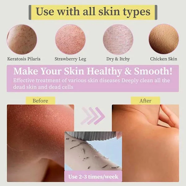 Burețel exfoliant pentru corp (set de 3)