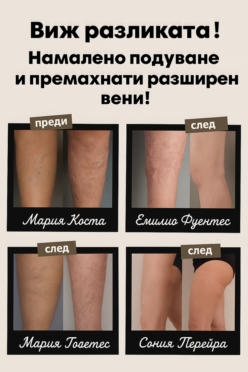 Акупресурни чорапи против разширени вени