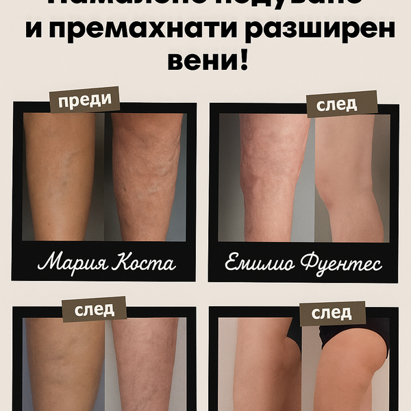 Акупресурни чорапи против разширени вени