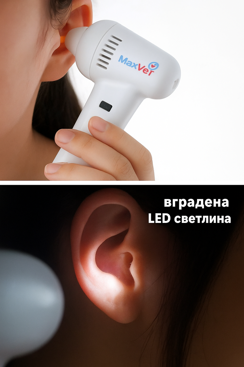 Електрически уред за почистване на ушна кал - Aurivioo™