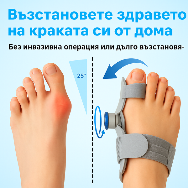 Спасител за болезнени буниони