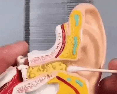 Електрически уред за почистване на ушна кал - Aurivioo™